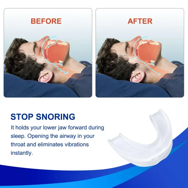 Sherry anti snoring devices，anti-snoring mouthguard, snoring solutiomouthguard for reducing snoring, reusable anti-snoring device for better sleepn - Image 2